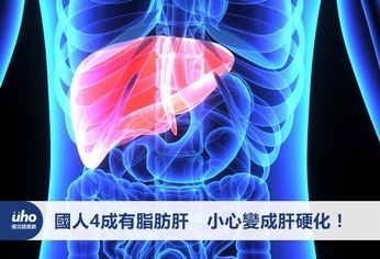 國人4成有脂肪肝 小心變成肝硬化!