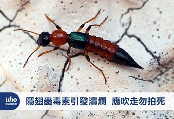 隱翅蟲毒素引發潰爛 應吹走勿拍死