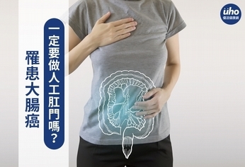 罹患大腸癌 一定要做人工肛門嗎?