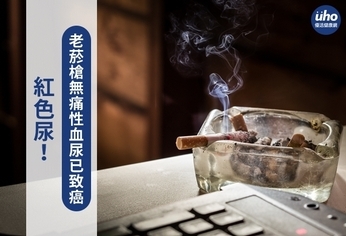 紅色尿!老菸槍無痛性血尿已致癌