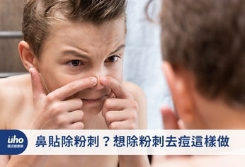 鼻貼除粉刺?想除粉刺去痘這樣做