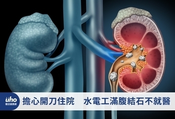 擔心開刀住院 水電工滿腹結石不就醫