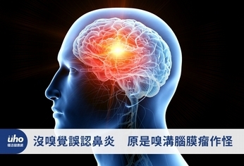 沒嗅覺誤認鼻炎 原是嗅溝腦膜瘤作怪