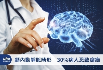 顱內動靜脈畸形 30%病人恐致癲癇