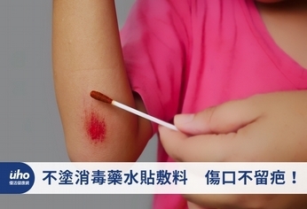 不塗消毒藥水貼敷料 傷口不留疤!