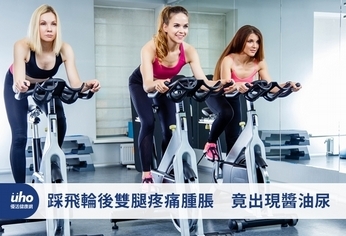 踩飛輪後雙腿疼痛腫脹 竟出現醬油尿