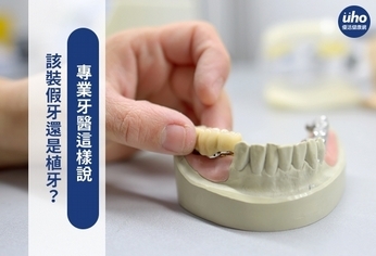 該裝假牙還是植牙?專業牙醫這樣說