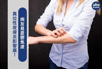 異位性皮膚炎影響廣!病友易憂鬱焦慮