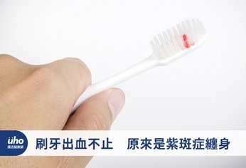 刷牙出血不止 原來是紫斑症纏身