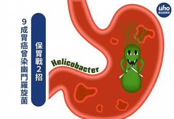 9成胃癌曾染幽門羅旋菌 保胃戰2招