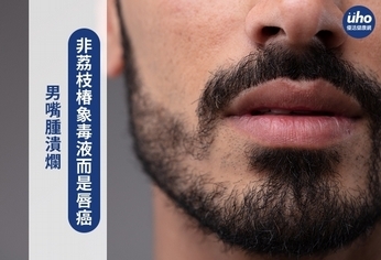 男嘴腫潰爛 非荔枝椿象毒液而是唇癌