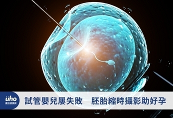 試管嬰兒屢失敗 胚胎縮時攝影助好孕