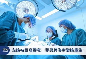 左臉被巨瘤吞噬 菲男跨海幸變臉重生