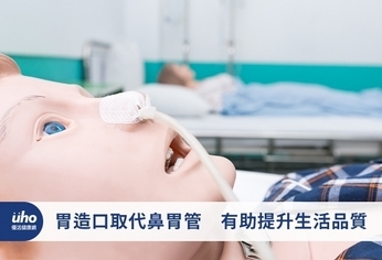 胃造口取代鼻胃管 有助提升生活品質