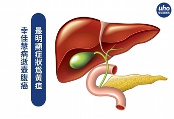 幸佳慧病逝壺腹癌 最明顯症狀為黃疸