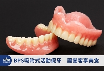 BPS吸附式活動假牙 讓饕客享美食