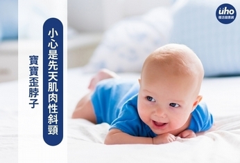 寶寶歪脖子　小心是先天肌肉性斜頸