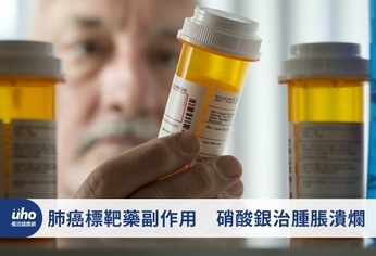 肺癌標靶藥副作用 硝酸銀治腫脹潰爛