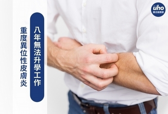 重度異位性皮膚炎 八年無法升學工作