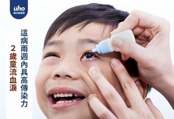 2歲童流血淚 這病兩週內具高傳染力