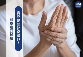 頭皮癢狂掉屑 竟然是關節炎徵兆!