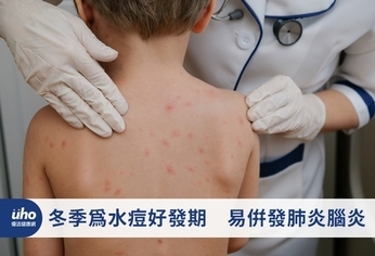 冬季為水痘好發期 易併發肺炎腦炎