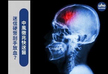 迷信硬幣刮手放血?中風徵兆快送醫