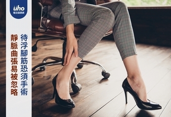 靜脈曲張易被忽略 待浮腳筋恐須手術