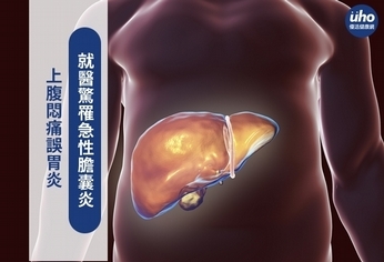 上腹悶痛誤胃炎 就醫驚罹急性膽囊炎