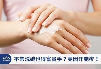 不常洗碗也得富貴手?竟因汗皰疹!