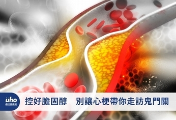 控好膽固醇 別讓心梗帶你走訪鬼門關