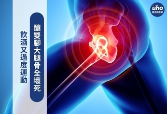 飲酒又過度運動 釀雙腳大腿骨全壞死