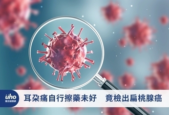 耳朵痛自行擦藥未好 竟檢出扁桃腺癌
