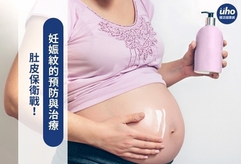 肚皮保衛戰！妊娠紋的預防與治療