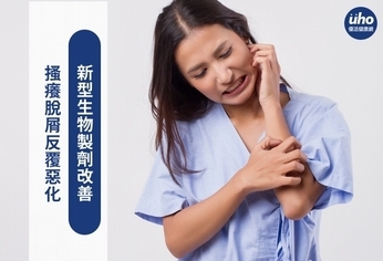 搔癢脫屑反覆惡化 新型生物製劑改善