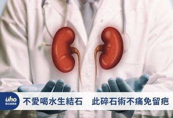 不愛喝水生結石 此碎石術不痛免留疤