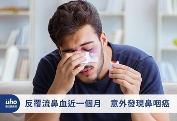 反覆流鼻血近一個月 意外發現鼻咽癌
