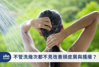 不管洗幾次都不見改善頭皮屑與搔癢?