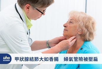 甲狀腺結節大如香腸 婦氣管險被壓扁