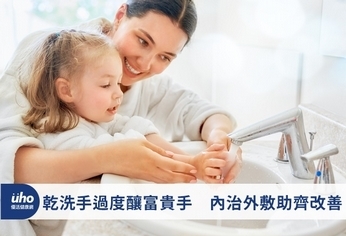 乾洗手過度釀富貴手 內治外敷助齊改善