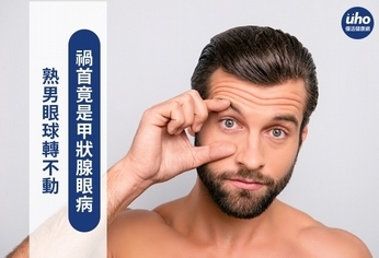 熟男眼球轉不動 禍首竟是甲狀腺眼病