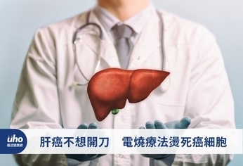 肝癌不想開刀 電燒療法燙死癌細胞