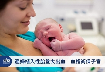產婦植入性胎盤大出血 血栓術保子宮