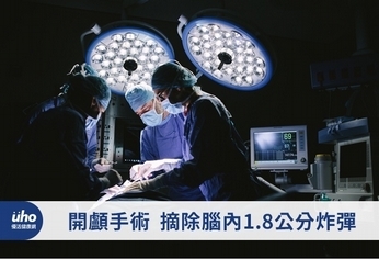 開顱手術 摘除腦內1.8公分炸彈