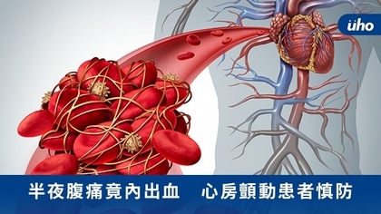 半夜腹痛竟內出血 心房顫動患者慎防
