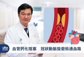 血管鈣化阻塞 冠狀動脈旋磨術通血路