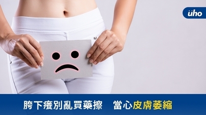 胯下癢別亂買藥擦 當心皮膚萎縮