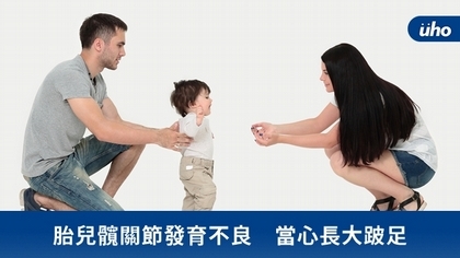 胎兒髖關節發育不良 當心長大跛足