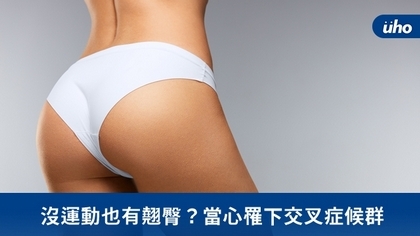 沒運動也有翹臀?當心罹下交叉症候群