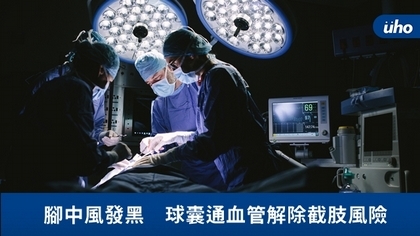 腳中風發黑 球囊通血管解除截肢風險